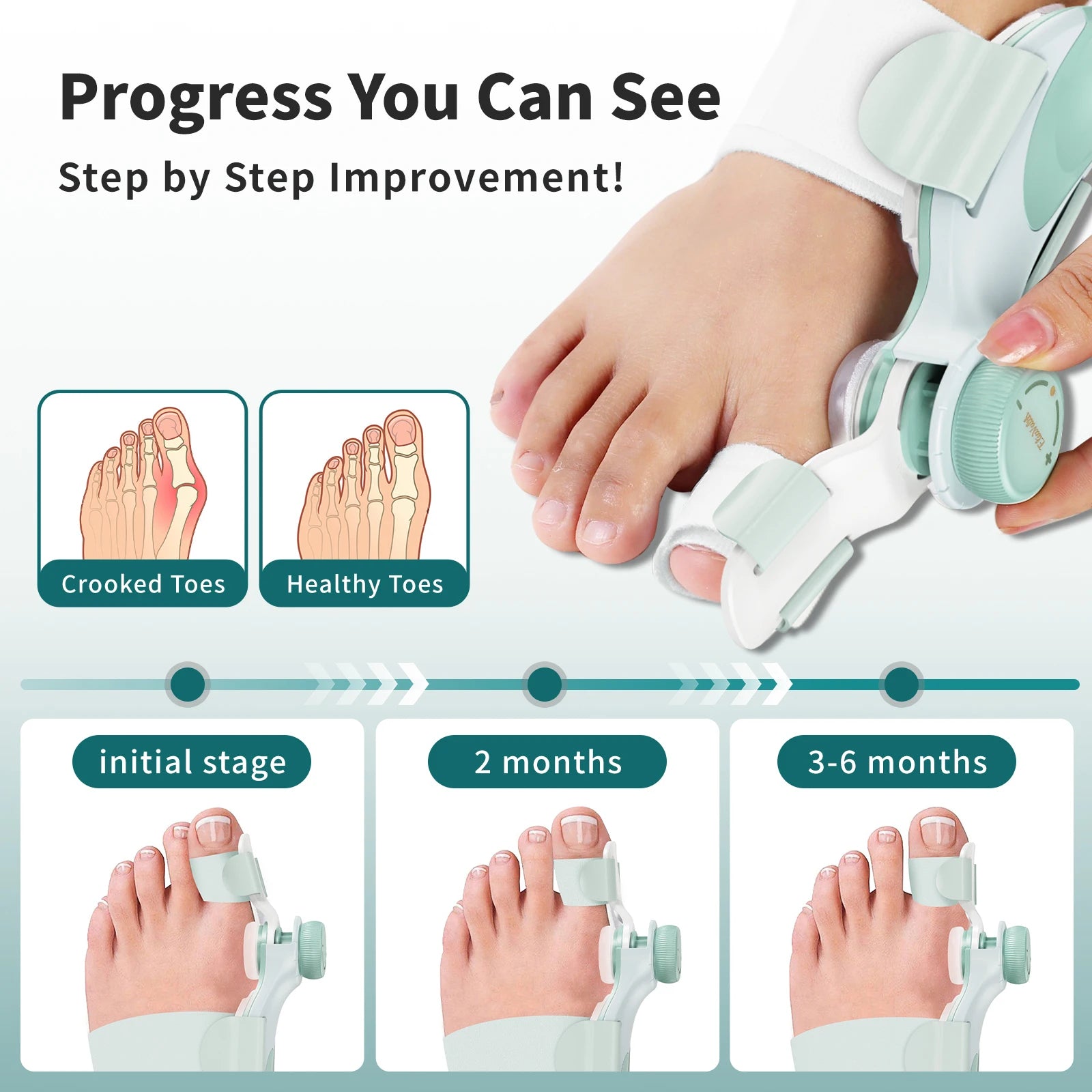 Precision Bunion Corrector with Adjustable Knob Flexible Fit Design for Daily Toe Separator & Support -