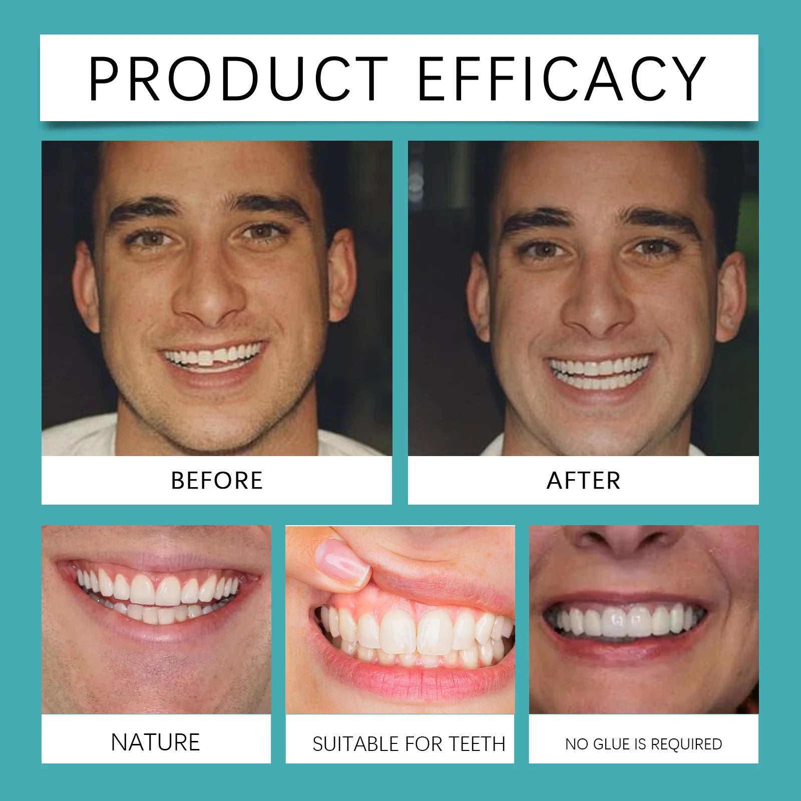 Adjustable Teeth Whitening -