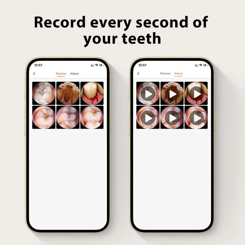 Effective Cleaning of Oral Recording Cameras -