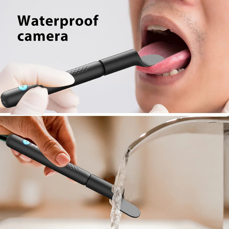 Effective Cleaning of Oral Recording Cameras -