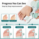 Precision Bunion Corrector with Adjustable Knob Flexible Fit Design for Daily Toe Separator & Support -
