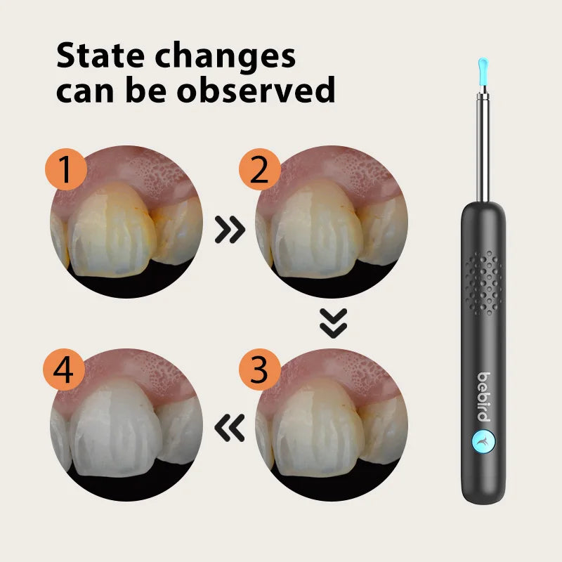 Effective Cleaning of Oral Recording Cameras -