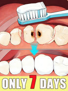 Tooth Repair (ToothPaste) -