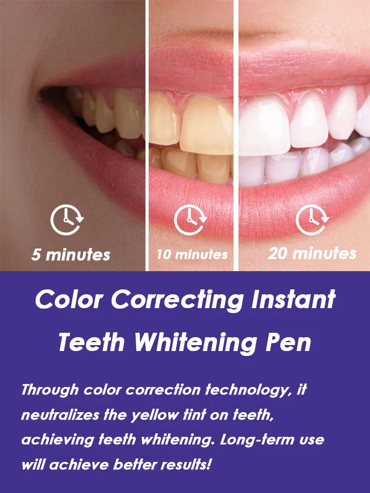 Teeth Whitening Pen -