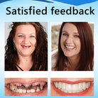 Silicone Dentures -