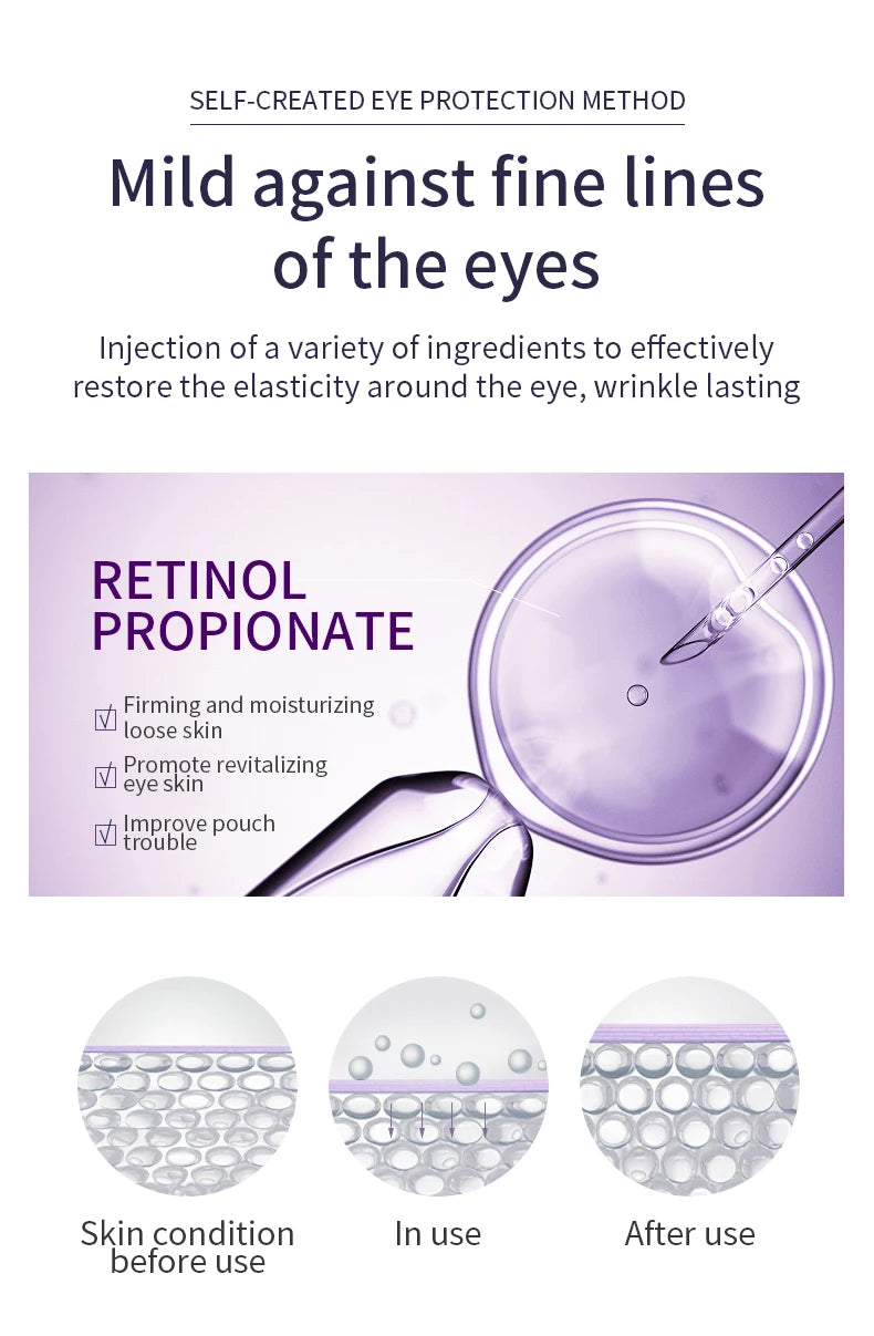 Revitalize your under-eye area with this anti-wrinkle and dark circle eye cream roller massager. The moisturizing formula and cooling roller can help reduce puffiness, and leave you with bright and refreshed eyes. -
