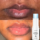 Remove Dark Lips Fast -