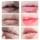 Remove Dark Lips Fast -