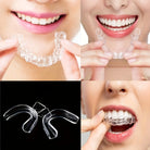 Teeth Aligner -