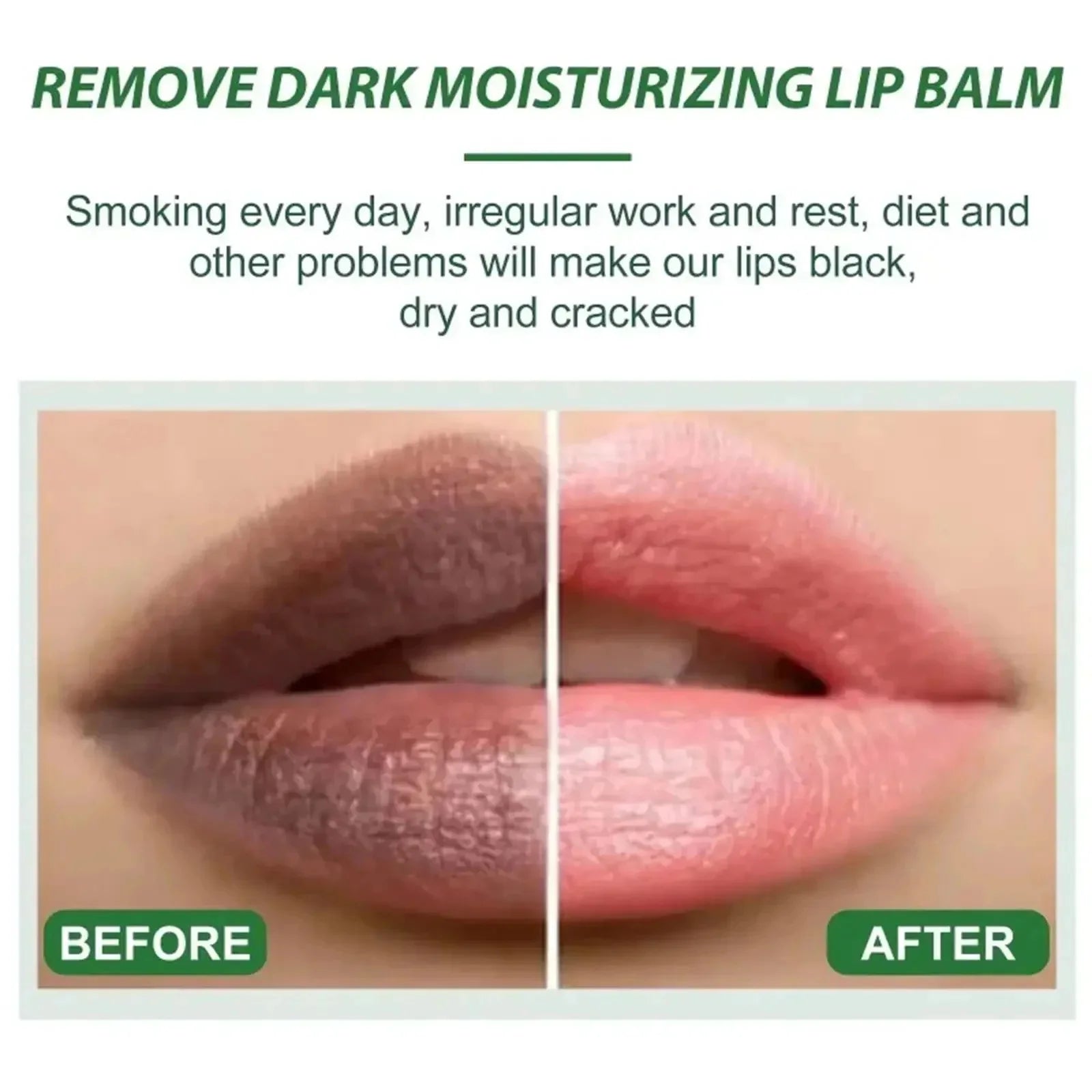 Remove Dark Lips Fast -