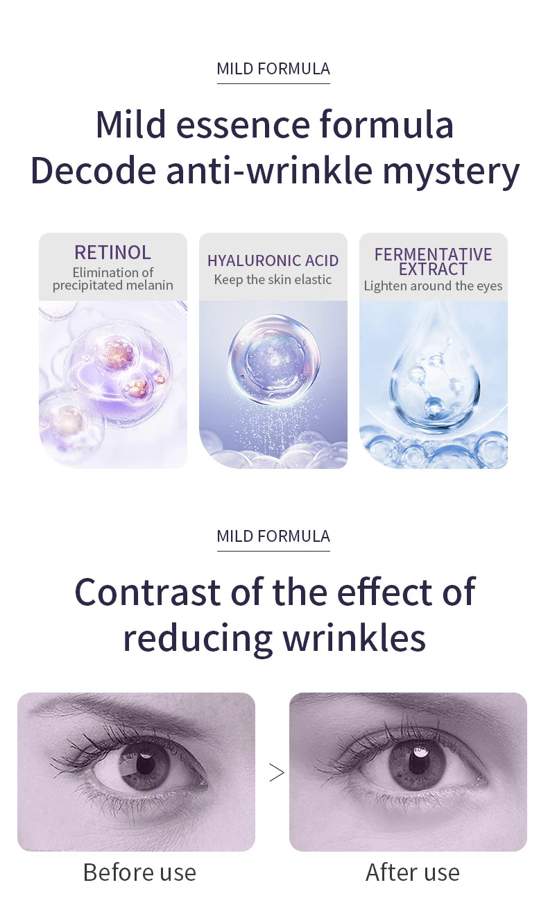 Revitalize your under-eye area with this anti-wrinkle and dark circle eye cream roller massager. The moisturizing formula and cooling roller can help reduce puffiness, and leave you with bright and refreshed eyes. -